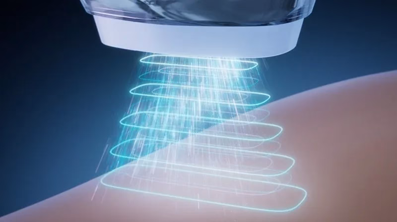 肌に照射される美容機器のイメージ図